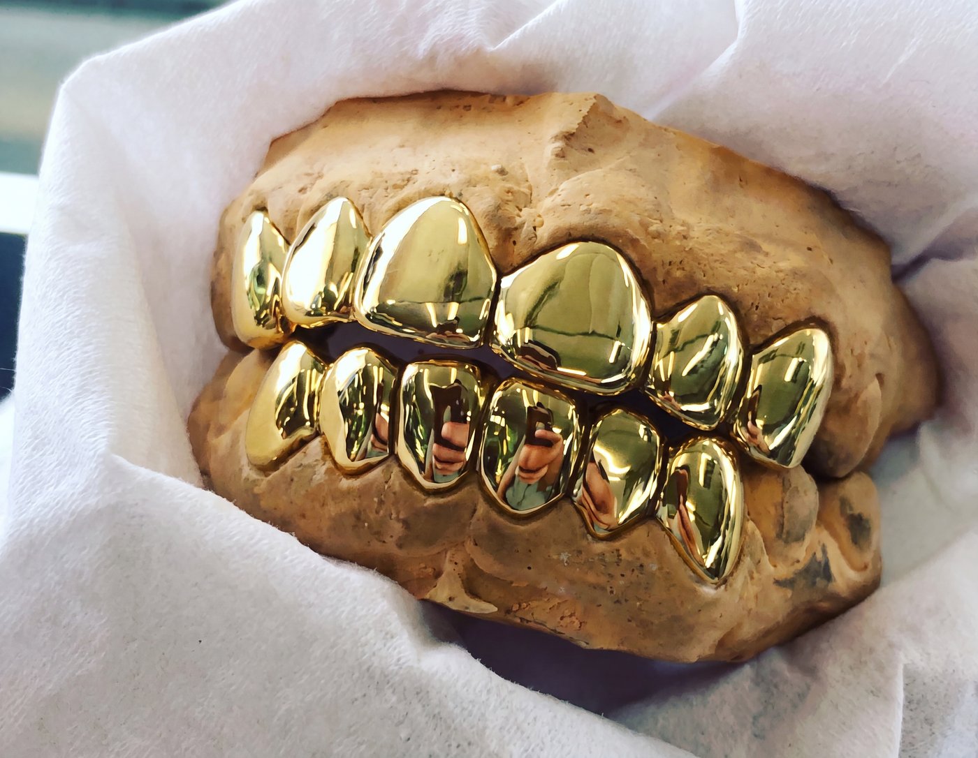 Solid gold grillz