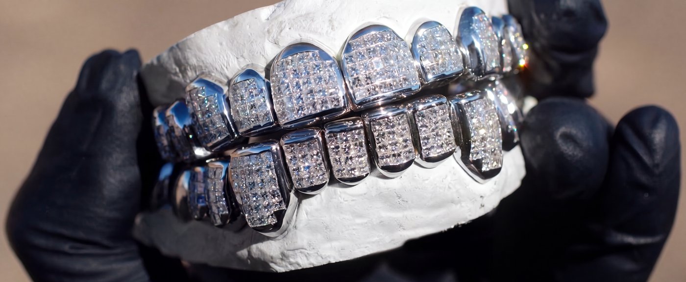 Iced out diamond grillz